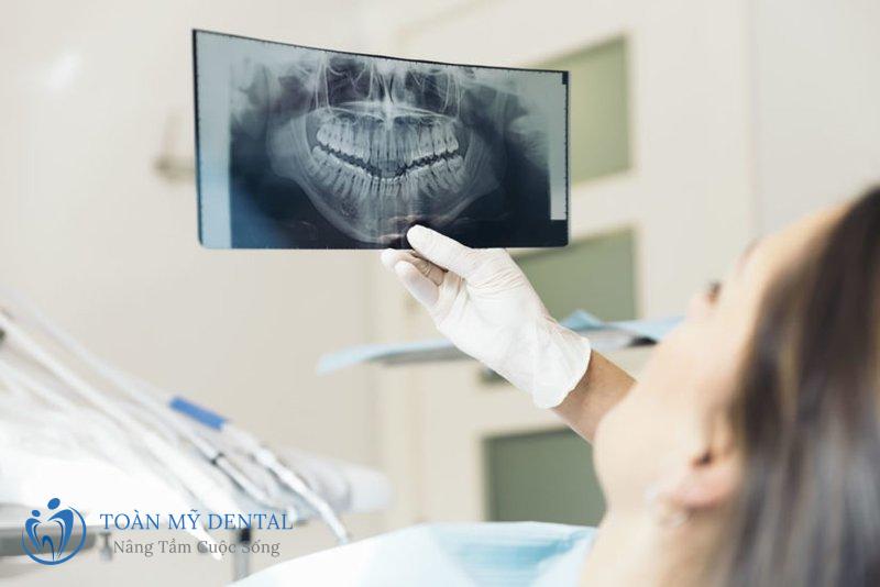 Chụp X-Quang và điều trị tổng quát trước khi niềng răng