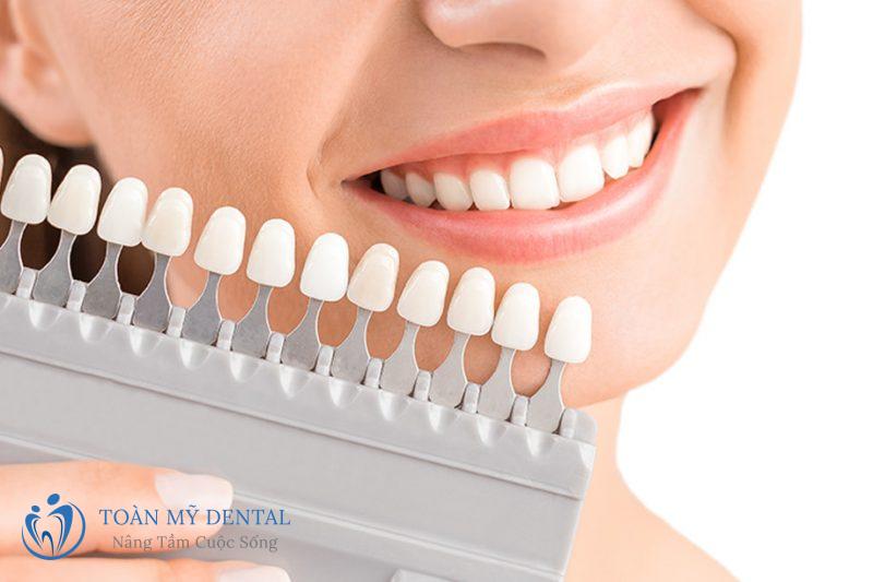 Bọc răng sứ thẩm mỹ
