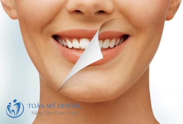 Tẩy trắng răng thường không làm ảnh hưởng đến men răng