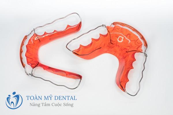 Đeo hàm duy trì để giúp cho răng ổn định hơn