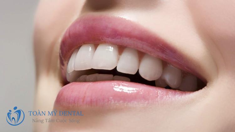 Dán sứ sườn Ziconia đang là công nghệ thẩm mỹ răng tiên tiến bậc nhất