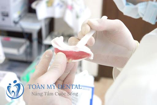 Lấy dấu răng