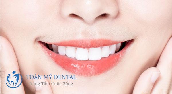 Không phải ai cũng nắm rõ các kinh nghiệm bọc răng sứ thẩm mỹ
