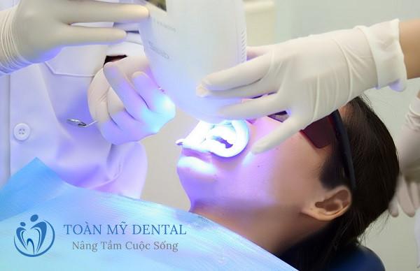 Có nên tẩy trắng răng bằng laser? Phương pháp này có an toàn hay không?